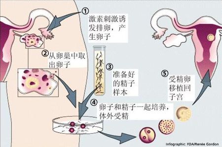 关于 供精代怀价格供卵